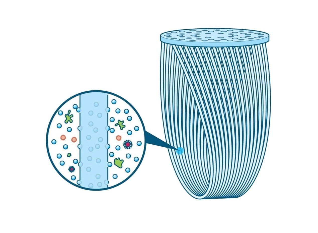 HFM Diagram 2017 1000x732